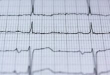 stellar pulse hyper beam